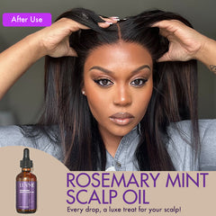 US Only | Luvme Rosemary Mint Scalp Oil, Scalp Care, Soothe & Strengthen | Add-on Item